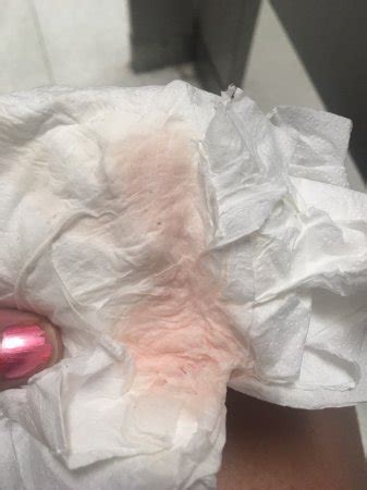 Pink Tinge On Toilet Paper After Urinating Menopause Riderkesil