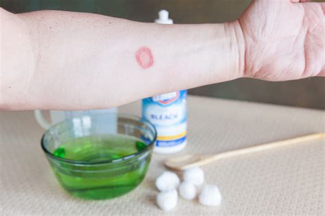 People who use this remedy report achieving. Use of Clorox in Treating Ringworm | Healthfully