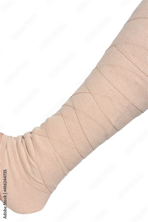 Lymphedema Management Wrapping Leg Using Multilayer Bandages To