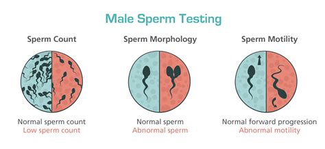 News Male Factor In Infertility Of Couples
