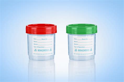 China Sample Container/Urine Container/Specimen Container/Urine Sample Container 90ml - China ...