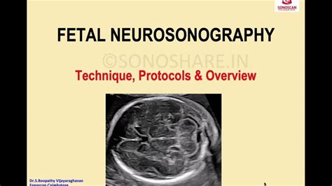 Fetal Neurosonography Technique Guidelines And Overview Youtube