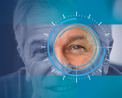 What Causes Halos Around Lights After Cataract Surgery Shelly Lighting