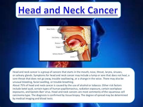 Signs And Symptoms Of Head And Neck Cancer