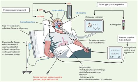 The Neurocritical Care Of Tuberculous Meningitis The Lancet Neurology