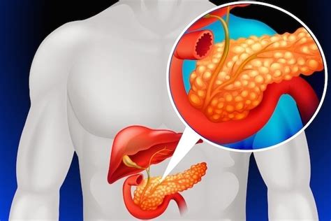 Pancreatite o que é sintomas e principais causas Tua Saúde