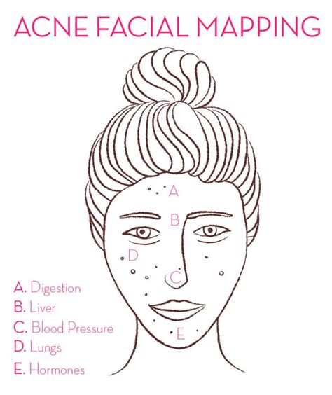 How To Use Facial Mapping To Reduce Breakouts Acne Facial Skin Care