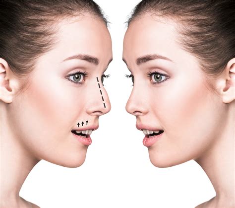 the 5 most popular plastic surgery procedures for women