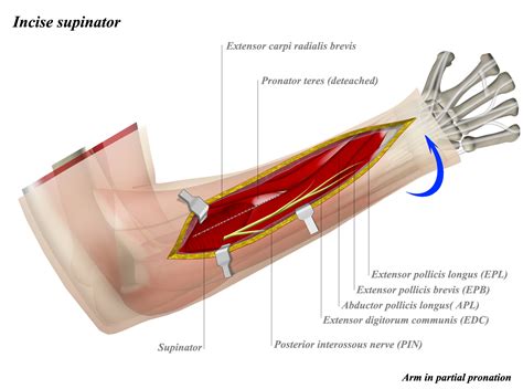 Forearm Dorsal Surgical Approach Anatomy Medbullets Step 23