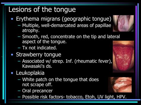 Syphilis Tongue Lesions