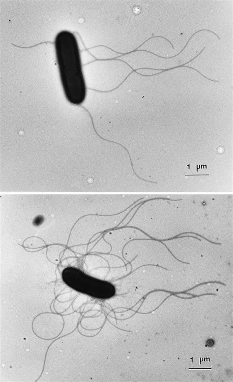 Transmission Electron Microscopy Of Salmonella Strains ␹ 3306 A And