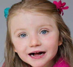 La sindrome di rett è una malattia gravemente invalidante che si manifesta tra i 2 ed i 4 anni, soprattutto tra le bambine. È a Roma il Congresso Europeo sulla sindrome di Rett