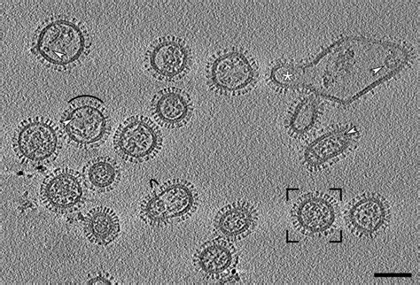 Virus Under Electron Microscope