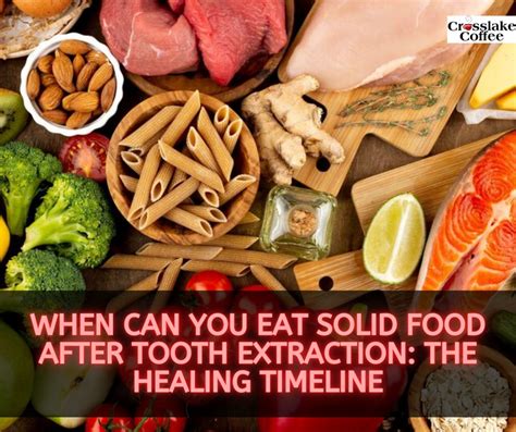When Can You Eat Solid Food After Tooth Extraction The Healing