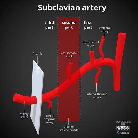 Branches Of Subclavian Artery Mnemonic Https My XXX Hot Girl