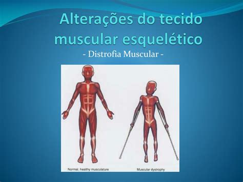 Doencas Do Sistema Esqueletico