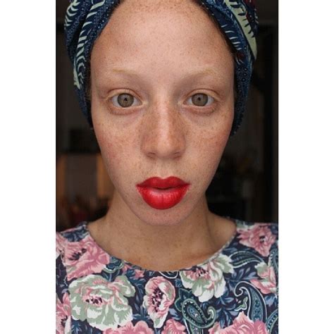 Freckled Black Women Demystify Freckle Folklore Vogue