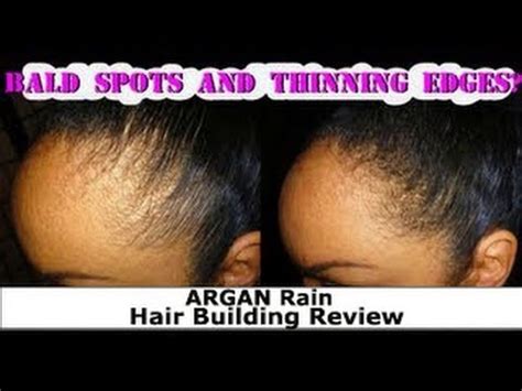 Hairstyles to disguise thinning hair. NO EDGES THINNING EDGES Hair Loss Bald Spots / ARGANRain ...