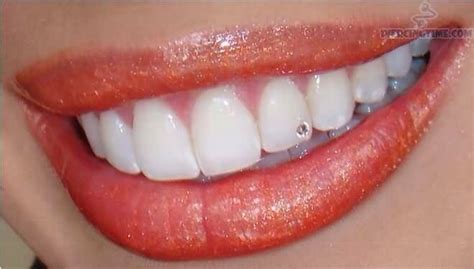 These Were Once Cool Teeth Jewelry Tooth Gem Diamond Teeth