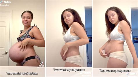 New Mom Shares What Her Stomach Looks Like Weeks Postpartum