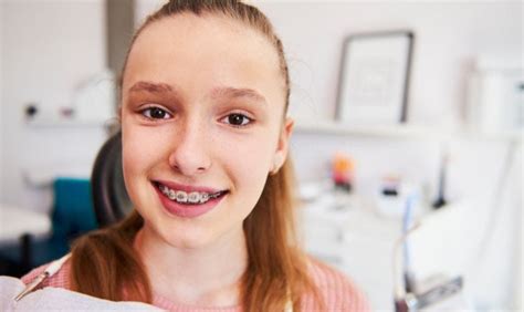 Choosing The Right Braces Exploring Options For Orthodontic Treatment By Compton Orthodontics