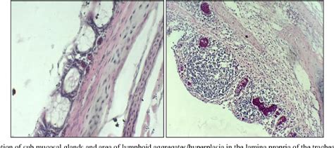 Figure 7 From Occurrence And Pathology Of Infectious Laryngotracheitis