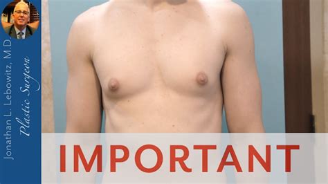 Answering Questions During Gynecomastia Surgery The Long Island Gynecomastia Center By Dr