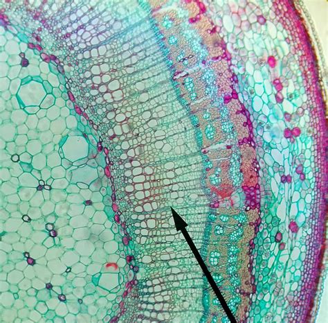 Plant Cell Wall Microscope Image Micropedia