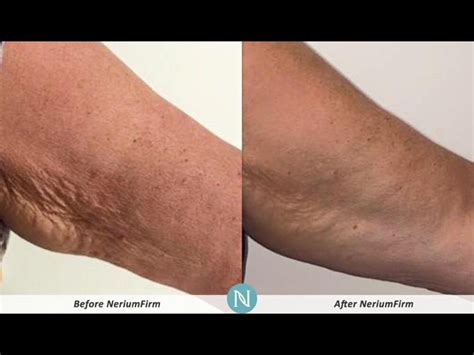 Nerium Firm Body Contour Cream Lorraine Siena Reid