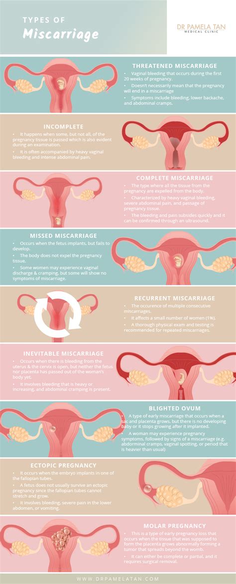 How To Detect Early Miscarriage Trackreply4