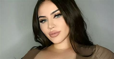 Womans Ultra Rare Condition Caused Her Boobs To Grow Six Cup Sizes In