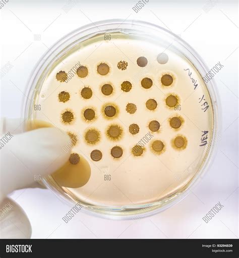 Fungi Grown On Agar Image And Photo Free Trial Bigstock