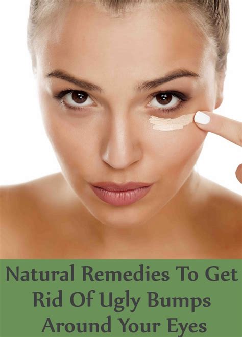 10 Natural Remedies To Get Rid Of Those Ugly Bumps Around Your Eyes