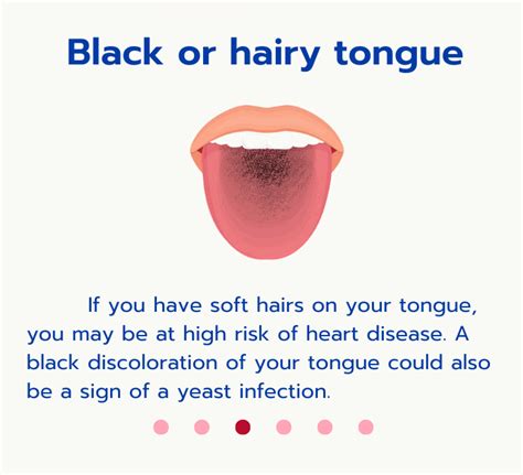 Did You Know Tongue Can Tell Disease Chiangmai Hospital Tel 053