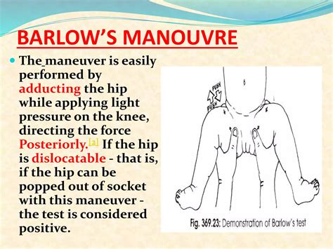 Examination Of Hipfinal