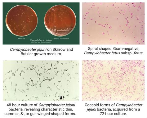 Campylobacteriosis Campylobacter Infection And Food Poisoning