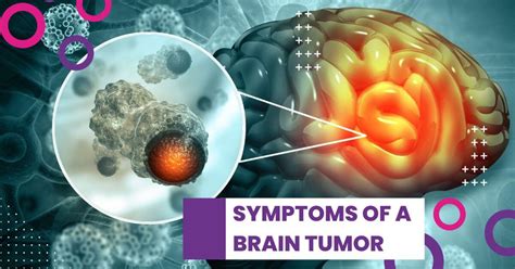What Are The Symptoms Of A Brain Tumor And When Should We Seek Medical
