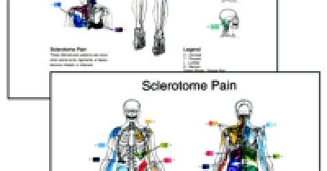 Sclerotome Pain Chart Set Poster Size