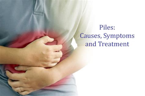 What Is Piles Cause Symptoms And Treatment Laser Piles Clinic