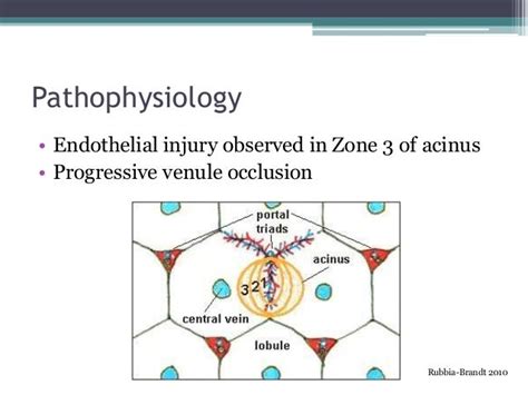 Veno Occlusive Disease