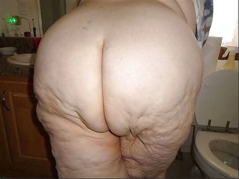 Dicker Oma Arsch Fat Granny Butt 1 Pics Xhamster