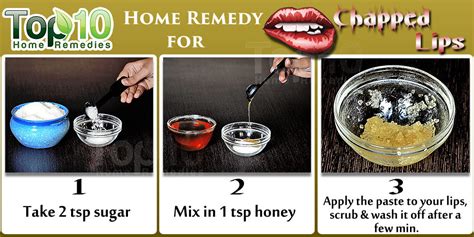 10 Natural Ways To Get Rid Of Chapped Lips Top 10 Home Remedies