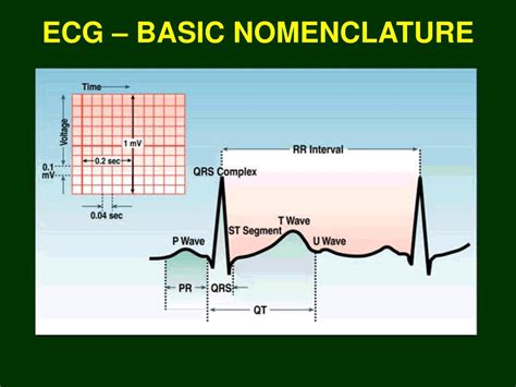 Ppt The Ecg Powerpoint Presentation Free Download Id884103