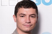 Shameless star Jody Latham goes from Lip to lip filler with £18m ...