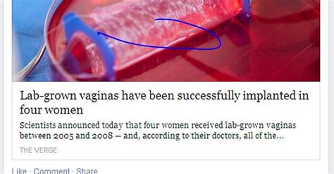 Lab Grown Vaginas Successfully Implanted In Four Women Imgur