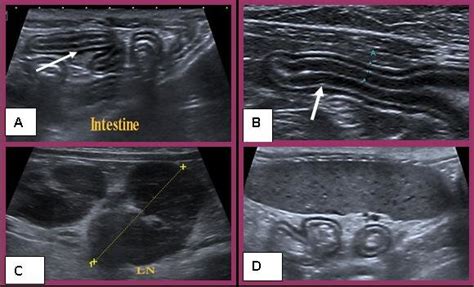 A B C D Ultrasound Longitudinal Scan In Cats With Lymphadenopathy