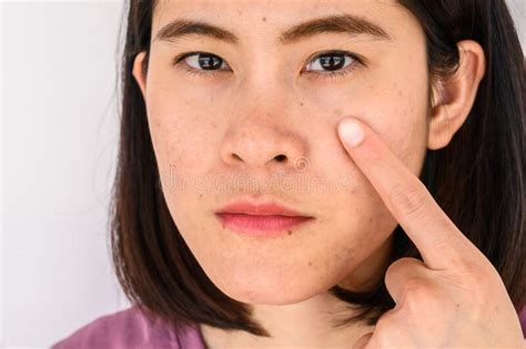 Close Up Of Woman Pointing A Problem On Her Face With Variety Problems