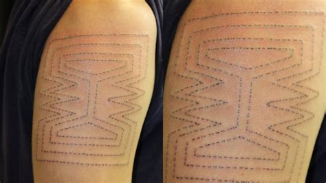 The Resurgence Of The Ancient Art Of Skin Stitch Tattoos