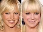 Anna Faris Before and After - The Skincare Edit