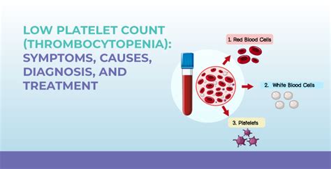 Low Platelet Count Thrombocytopenia Symptoms Causes Diagnosis And